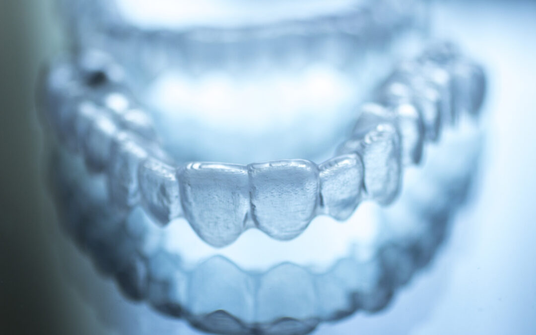 Invisalign in Shawnessy