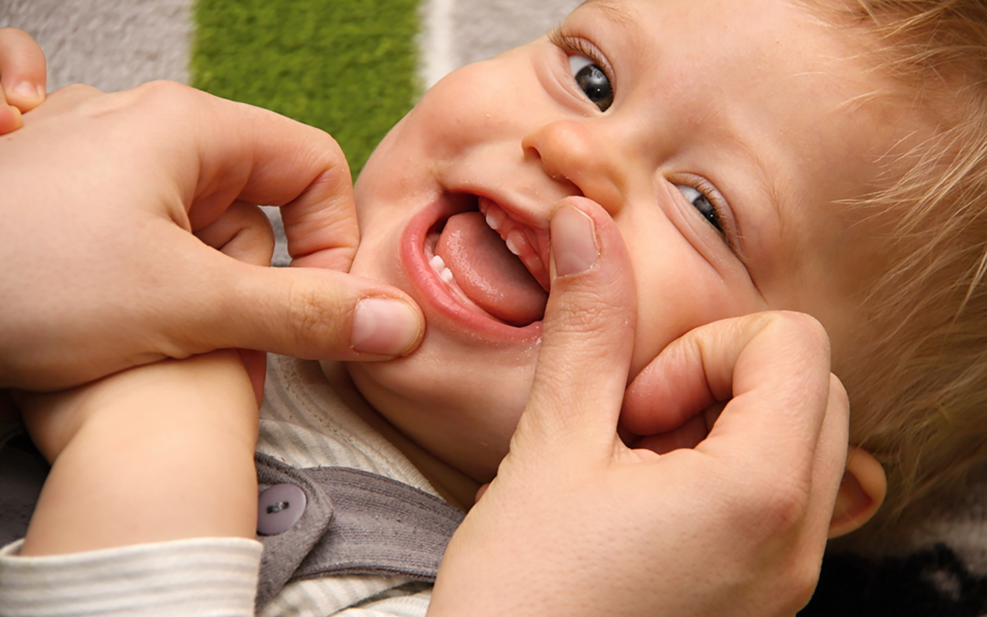 How to Fix Cavities In Baby Teeth?