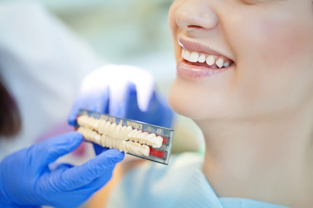 How Do I Know If My Dental Bridge Is Falling?